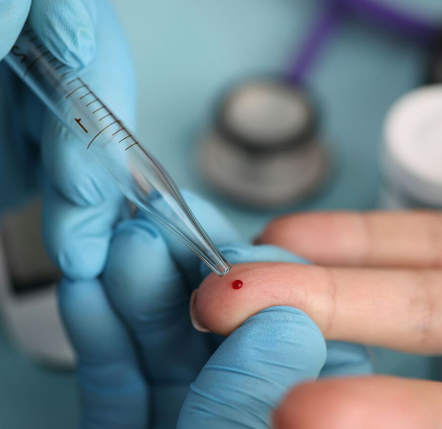 Blood test